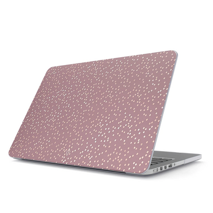 BURGA Hot Cocoa Case for MacBook