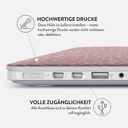 BURGA Hot Cocoa Case for MacBook